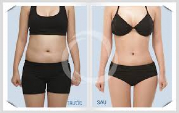 Cách giảm mỡ bụng nhanh nhất trong 1 tuần bằng công nghệ cao - Mạng làm giàu