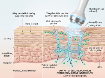 Electroporation trong làm đẹp hỗ trợ đưa hoạt chất thế nào?